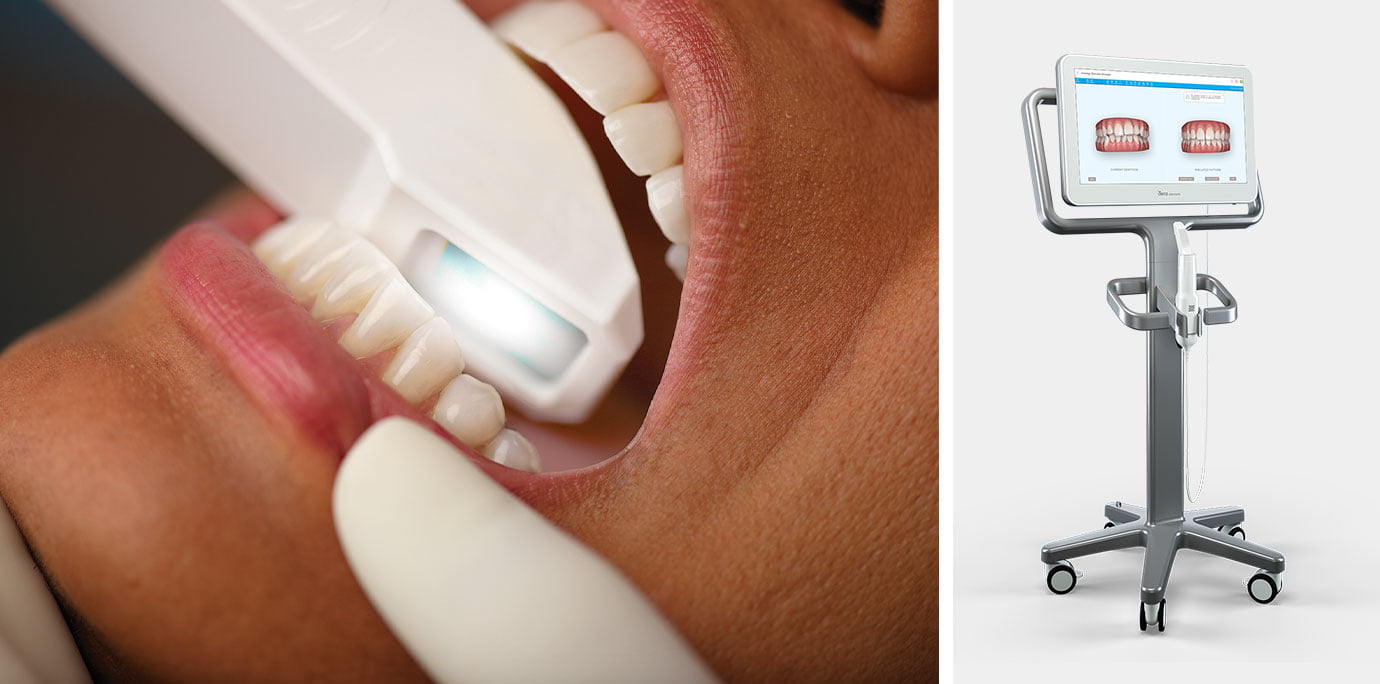 Orthodontic Consultations